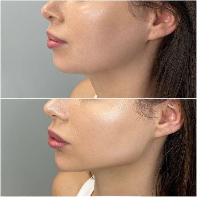 Full Face